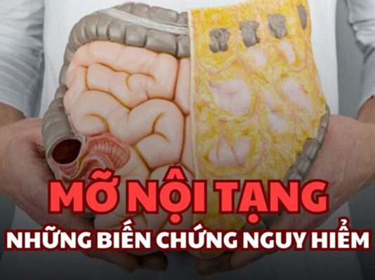 Nguyên nhân gây mỡ nội tạng, một số cách kiểm soát mỡ nội tạng trong cơ thể