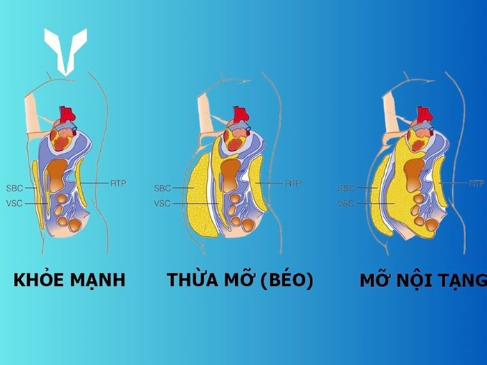 Những thức uống nào giúp giảm mỡ nội tạng hiệu quả tại nhà