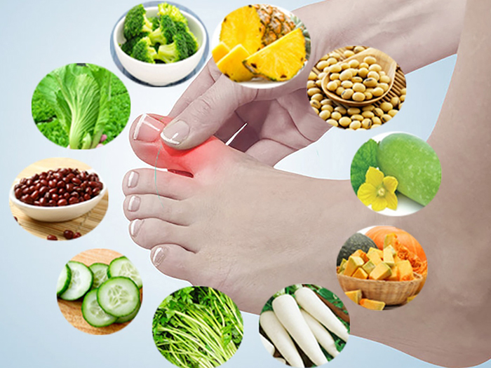 Có nên cho người bị bệnh Gout ăn thịt Vịt không?