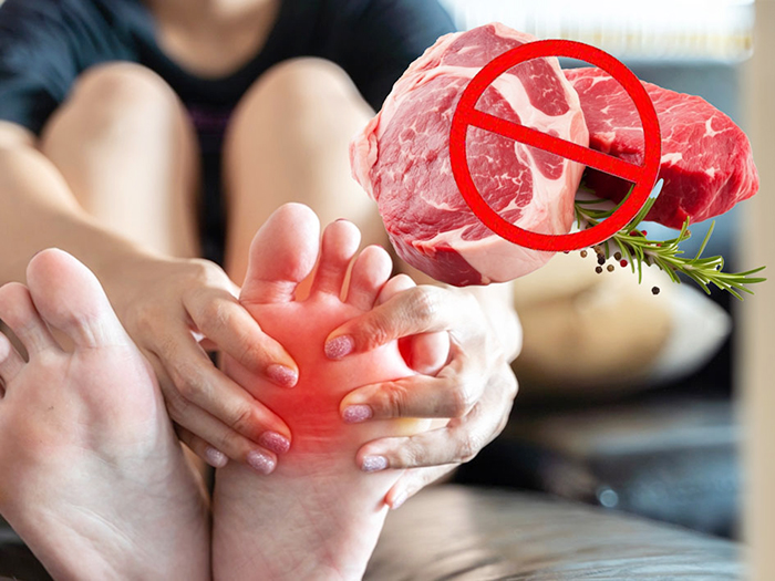 [Góc thắc mắc]: Bệnh Gout có di truyền không?