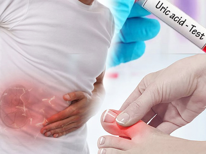 Axit uric tăng cao những bộ phận cơ thể nào sẽ bị ảnh hưởng?
