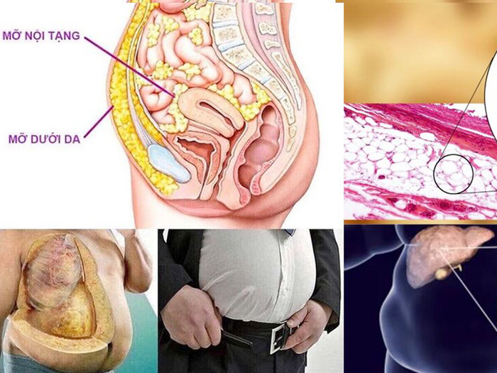 Bạn nên ăn 5 loại cá này thường xuyên giúp giảm mỡ nội tạng hiệu quả