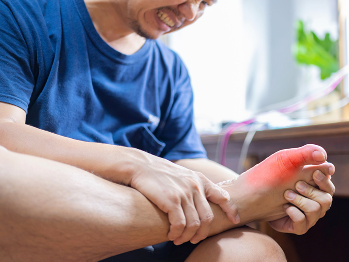 Bệnh gút (Gout) có ảnh hưởng tới sức khoẻ sinh lý nam giới không?