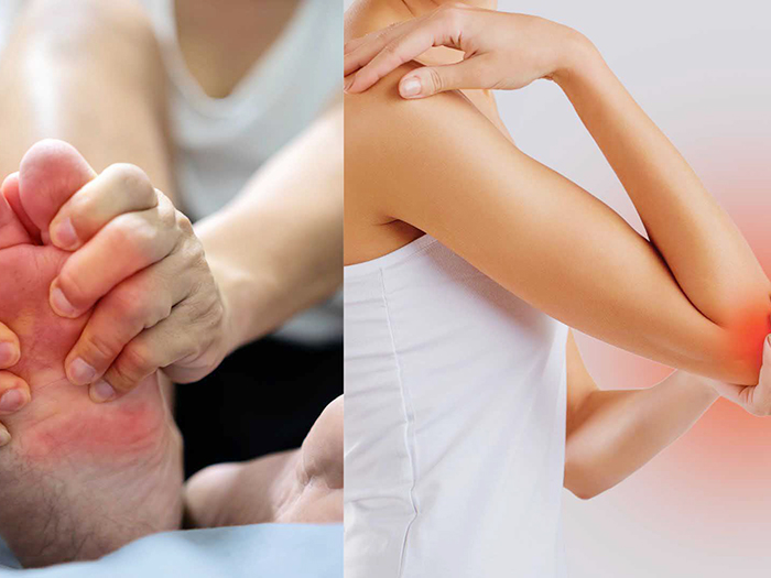 Những nguy cơ khi Acid Uric tăng cao trong mùa hè nắng nóng