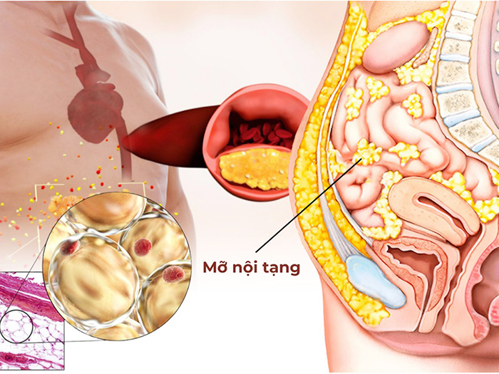 Cách giảm mỡ nội tạng đơn giản với 5 nguyên liệu nấu cùng cơm mỗi ngày
