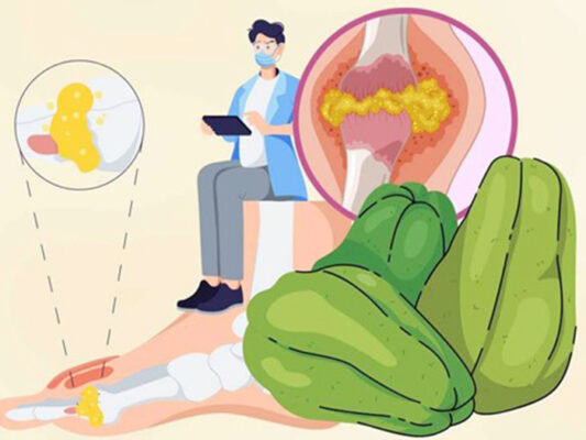 Bật mí lý do người bị axit uric cao cần tăng cường ăn quả su su