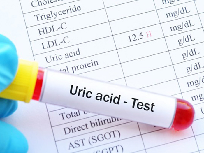 Bật mí lý do người bị axit uric cao cần tăng cường ăn quả su su