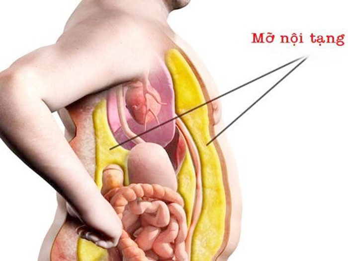 Cách đo chỉ số mỡ nội tạng ở nữ giới chính xác nhất