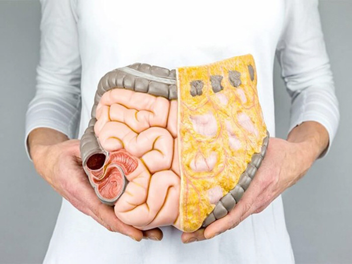 Mỡ Nội Tạng và Mỡ Dưới Da là gì? Cách phân biệt & giảm mỡ hiệu quả