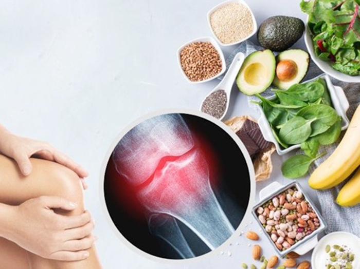 Top những thực phẩm giảm nhức mỏi cơ thể hiệu quả nhất bạn nên biết