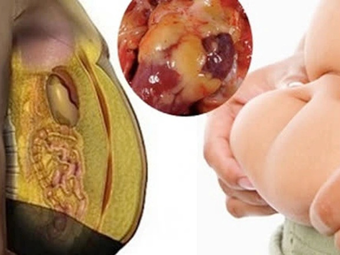 7 loại nước uống giúp tiêu mỡ nội tạng hiệu quả bạn nên thử