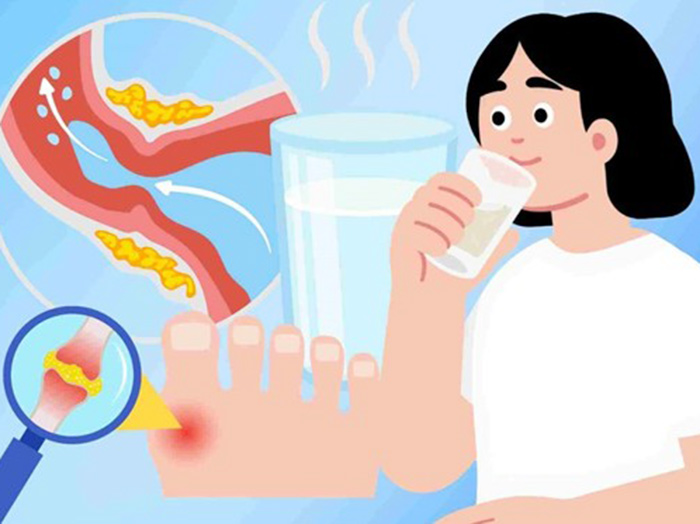Người cao tuổi bị acid uric cao nên uống bao nhiêu nước mỗi ngày?