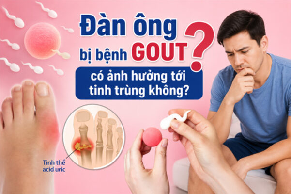 Đàn ông bị bệnh gout có ảnh hưởng tới tinh trùng không?