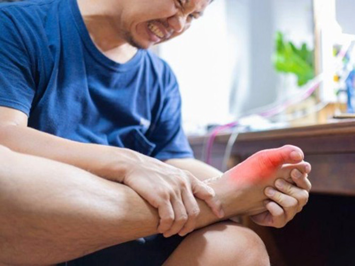 Đàn ông bị bệnh gout có ảnh hưởng tới tinh trùng không?