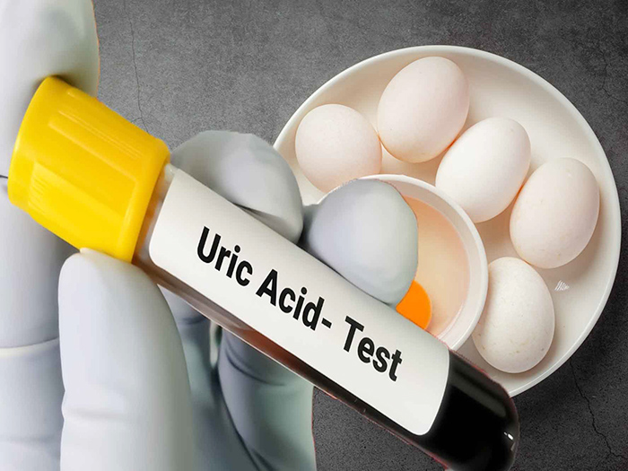 Người có chỉ số axit uric cao có được ăn trứng không?